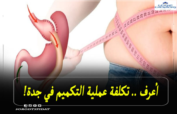 تكلفة عملية التكميم في جدة 2021 وأسعار المستشفيات عروض وتخفيضات