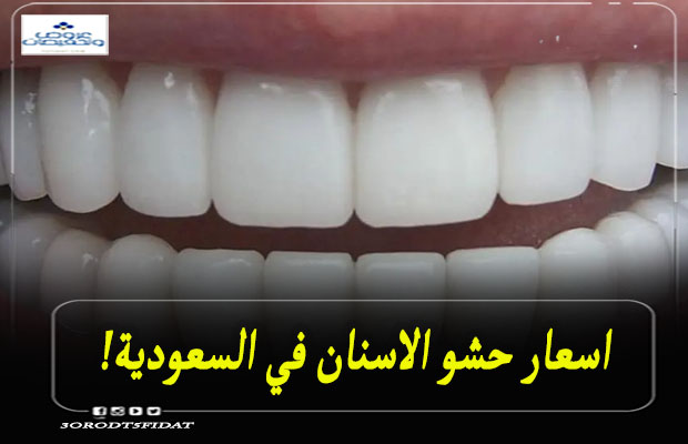 اسعار حشو الاسنان في السعودية