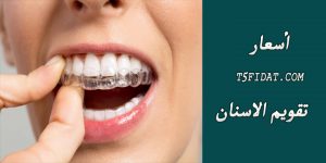 سعر تقويم الاسنان في مصر والسعودية 2022 بالجنيه المصري والريال