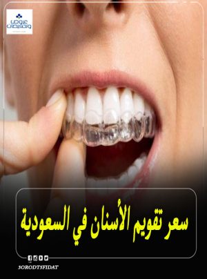 سعر تقويم الأسنان في السعودية 1443 في العيادات والمراكز الطبية
